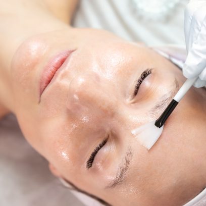 Gros plan sur un chirurgien esthétique en train d'appliquer un peeling au phénol sur une jeune cliente dans une clinique de chirurgie esthétique.